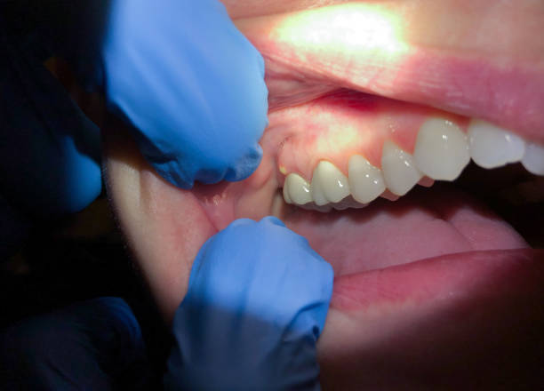 Best Broken or Cracked Tooth Emergency Dentist in Lewiston, CA